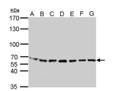 STI1 Antibody, Novus Biologicals 0.1mg; Unlabeled:Antibodies, Polyclonal