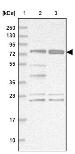 STIM2 Antibody, Novus Biologicals 0.1mL; Unlabeled:Antibodies, Polyclonal
