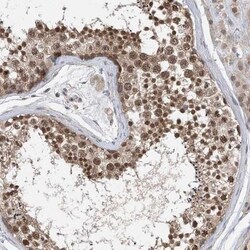 STK19 Antibody, Novus Biologicals 25 &mu;L | Buy Online | Novus Biologicals | Fisher Scientific