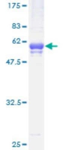 Novus Biologicals Recombinant Human STK22C GST (N-Term) Protein 25 &mu;g | Buy Online | Novus Biologicals&trade; | Fisher Scientific