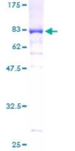 Novus Biologicals Recombinant Human STK25 GST (N-Term) Protein 2 &mu;g | Buy Online | Novus Biologicals&trade; | Fisher Scientific