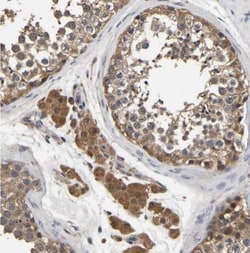 STK32C Antibody, Novus Biologicals:Antibodies:Primary Antibodies