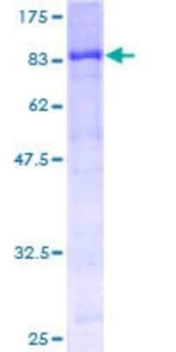 Novus Biologicals Recombinant Human STK33 GST (N-Term) Protein 10 &mu;g | Buy Online | Novus Biologicals&trade; | Fisher Scientific