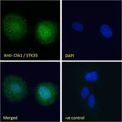STK35 Antibody, Novus Biologicals 0.1mg; Unlabeled:Antibodies, Polyclonal
