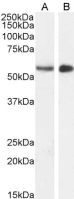 STK35 Antibody, Novus Biologicals 0.1mg; Unlabeled:Antibodies, Polyclonal