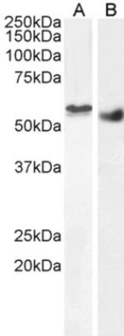 STK35 Antibody, Novus Biologicals 0.1mg; Unlabeled:Antibodies, Polyclonal