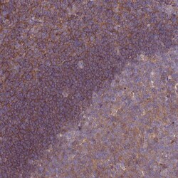 STK38L Antibody, Novus Biologicals 0.1mL; Unlabeled:Antibodies, Polyclonal