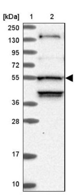 STK38L Antibody, Novus Biologicals 0.1mL; Unlabeled:Antibodies, Polyclonal