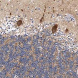 STMN3 Antibody, Novus Biologicals 25ul | Buy Online | Novus Biologicals | Fisher Scientific