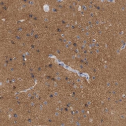 STMN3 Antibody, Novus Biologicals 25ul | Buy Online | Novus Biologicals | Fisher Scientific