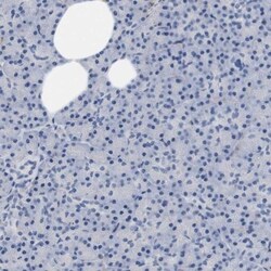 STMN3 Antibody, Novus Biologicals 25ul | Buy Online | Novus Biologicals | Fisher Scientific