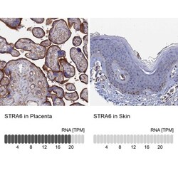 STRA6 Antibody, Novus Biologicals 25 &mu;L | Buy Online | Novus Biologicals | Fisher Scientific