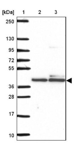 STRAP Antibody, Novus Biologicals 0.1mL; Unlabeled:Antibodies, Polyclonal