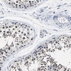 STRBP Antibody, Novus Biologicals 25 &mu;L; Unlabeled:Antibodies, Polyclonal