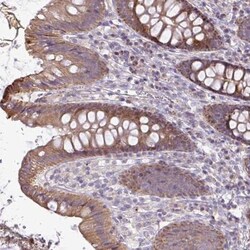 STRIP1 Antibody, Novus Biologicals 0.1mL; Unlabeled:Antibodies, Polyclonal