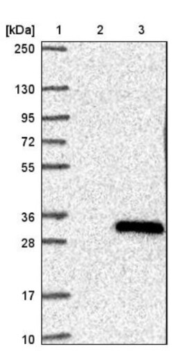 STYX Antibody, Novus Biologicals 0.1mL; Unlabeled:Antibodies, Polyclonal