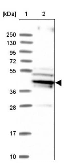 SUCLA2 Antibody, Novus Biologicals 0.1mL; Unlabeled:Antibodies, Polyclonal