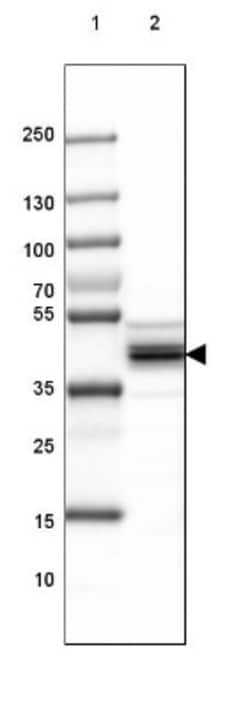 SUCLA2 Antibody, Novus Biologicals 0.1mL; Unlabeled:Antibodies, Polyclonal