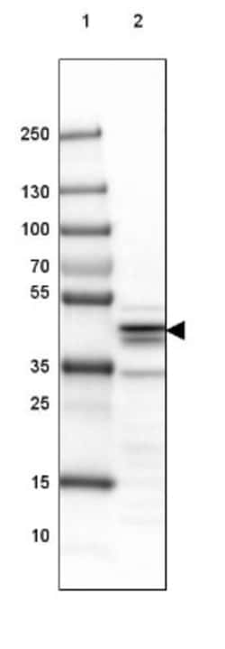 SUCLA2 Antibody, Novus Biologicals 0.1mL; Unlabeled:Antibodies, Polyclonal