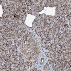 SUCLG1 Antibody, Novus Biologicals 25 &mu;L; Unlabeled:Antibodies, Polyclonal