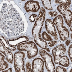 SUCLG1 Antibody, Novus Biologicals:Antibodies:Primary Antibodies