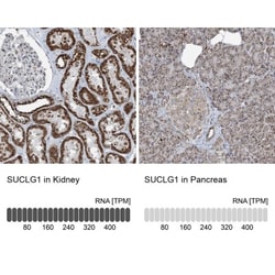 SUCLG1 Antibody, Novus Biologicals:Antibodies:Primary Antibodies