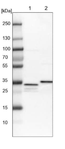 SUCLG1 Antibody, Novus Biologicals 25 &mu;L; Unlabeled:Antibodies, Polyclonal