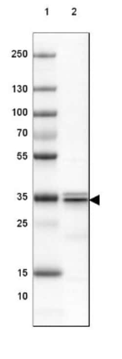 SUCLG1 Antibody, Novus Biologicals 25 &mu;L; Unlabeled:Antibodies, Polyclonal