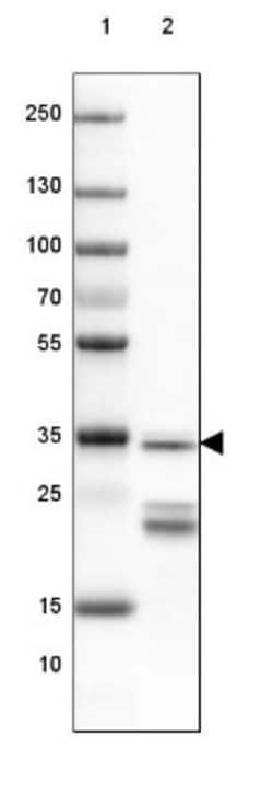 SUCLG1 Antibody, Novus Biologicals 25 &mu;L; Unlabeled:Antibodies, Polyclonal