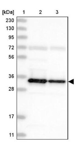 SUCLG1 Antibody, Novus Biologicals:Antibodies:Primary Antibodies