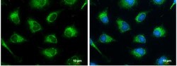 SUCLG2 Antibody, Novus Biologicals 0.1mL; Unlabeled:Antibodies, Polyclonal