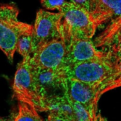 SUCLG2 Antibody, Novus Biologicals 25 &mu;L; Unlabeled:Antibodies, Polyclonal