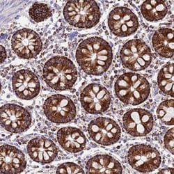 SUCLG2 Antibody, Novus Biologicals 25 &mu;L; Unlabeled:Antibodies, Polyclonal