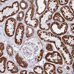 SUCLG2 Antibody, Novus Biologicals 25 &mu;L; Unlabeled:Antibodies, Polyclonal