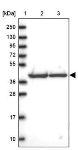 SUCLG2 Antibody, Novus Biologicals 25 &mu;L; Unlabeled:Antibodies, Polyclonal