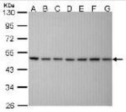 SUG1 Antibody (25D5), Novus Biologicals 0.1mg; Unlabeled:Antibodies, Monoclonal
