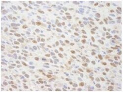 SUG1 Antibody, Novus Biologicals 0.1mL; Unlabeled:Antibodies, Polyclonal