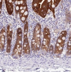 SULT1A2 Antibody, Novus Biologicals 0.1mL; Unlabeled:Antibodies, Polyclonal