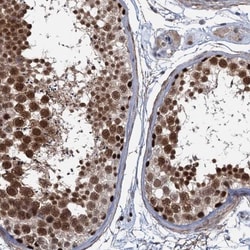 SUMO Activating Enzyme E1 (SAE1) Antibody, Novus Biologicals 0.1mL; Unlabeled:Antibodies,