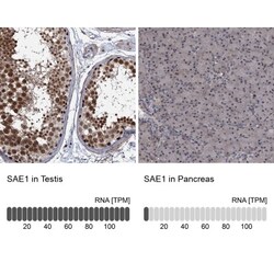 SUMO Activating Enzyme E1 (SAE1) Antibody, Novus Biologicals 0.1mL; Unlabeled:Antibodies,