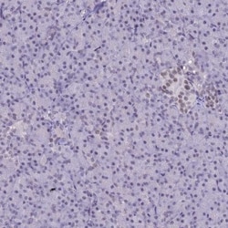 SUMO Activating Enzyme E1 (SAE1) Antibody, Novus Biologicals:Antibodies:Primary