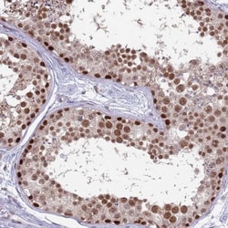 SUMO Activating Enzyme E1 (SAE1) Antibody, Novus Biologicals:Antibodies:Primary