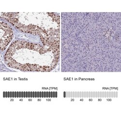 SUMO Activating Enzyme E1 (SAE1) Antibody, Novus Biologicals:Antibodies:Primary