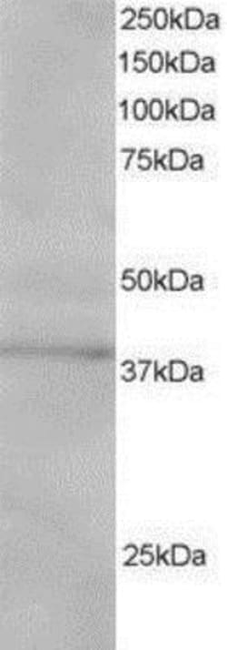 SUMO Activating Enzyme E1 (SAE1) Antibody, Novus Biologicals 0.1mg; Unlabeled:Antibodies,