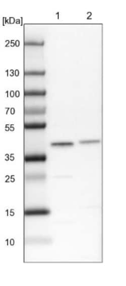 SUMO Activating Enzyme E1 (SAE1) Antibody, Novus Biologicals 0.1mL; Unlabeled:Antibodies,