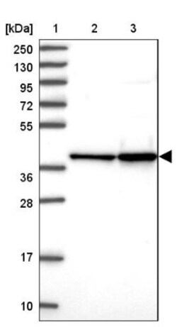 SUMO Activating Enzyme E1 (SAE1) Antibody, Novus Biologicals:Antibodies:Primary