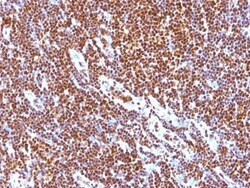 SUMO1 Antibody (SUMO1/1188), Novus Biologicals 0.2mg; Unlabeled:Antibodies,
