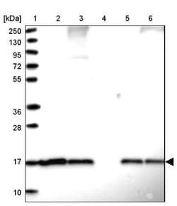 SUMO4 Antibody, Novus Biologicals 25 &mu;L | Buy Online | Novus Biologicals | Fisher Scientific