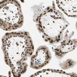 SUN1 Antibody, Novus Biologicals 0.1mL; Unlabeled:Antibodies, Polyclonal