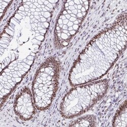 SUPT16H Antibody, Novus Biologicals 0.1 mL | Buy Online | Novus Biologicals | Fisher Scientific